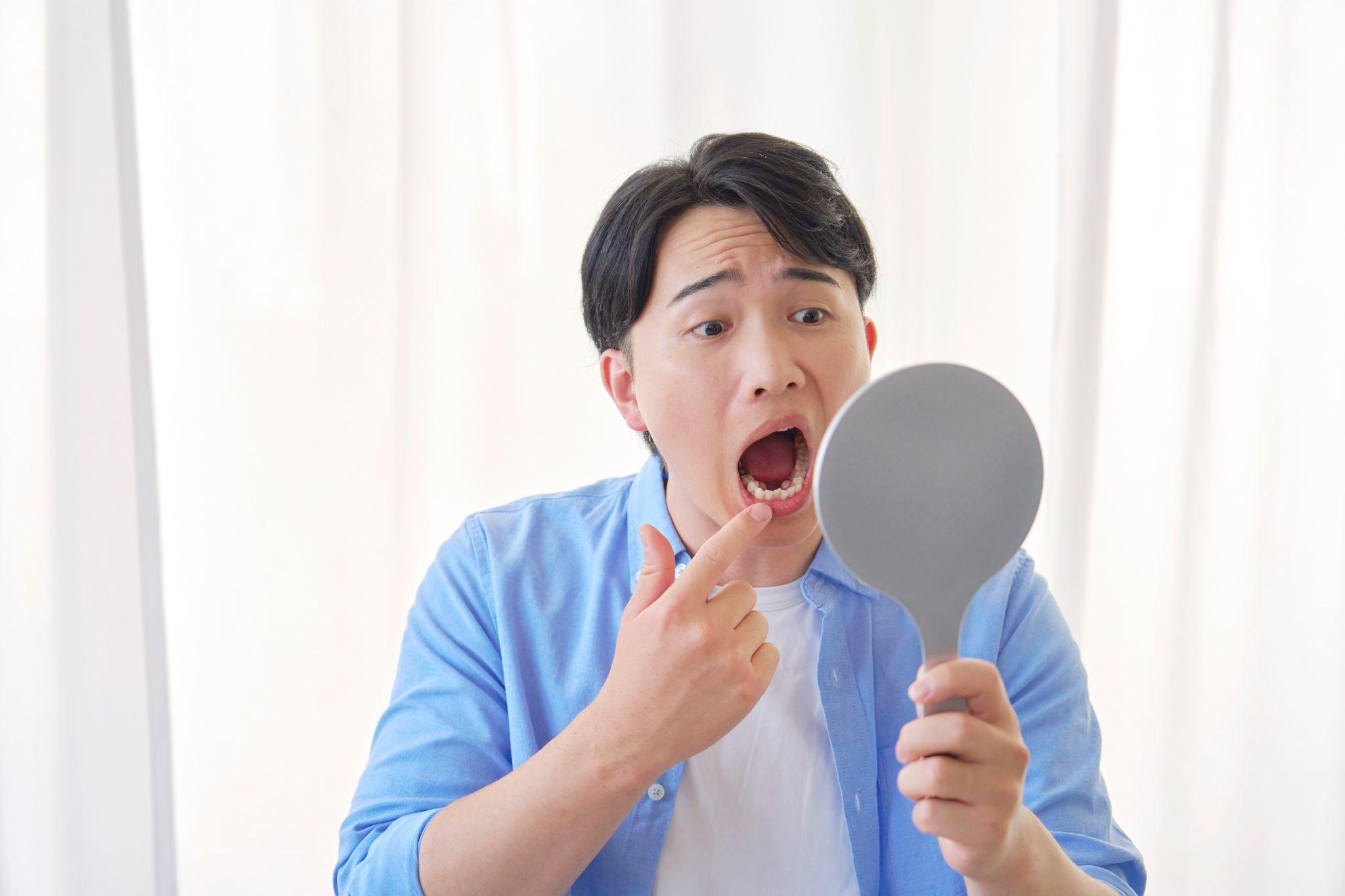 そもそも歯の黄ばみの原因って？