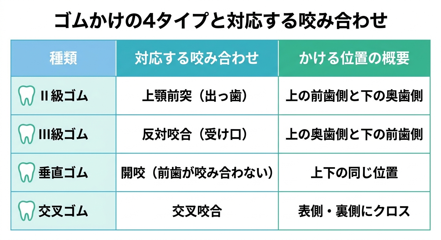 ゴムかけの種類｜症状別の4タイプとかけ方