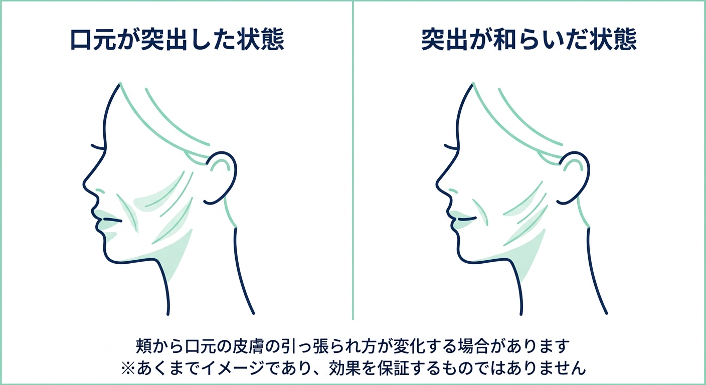 出っ歯・口ゴボの改善で口元の突出が減る場合