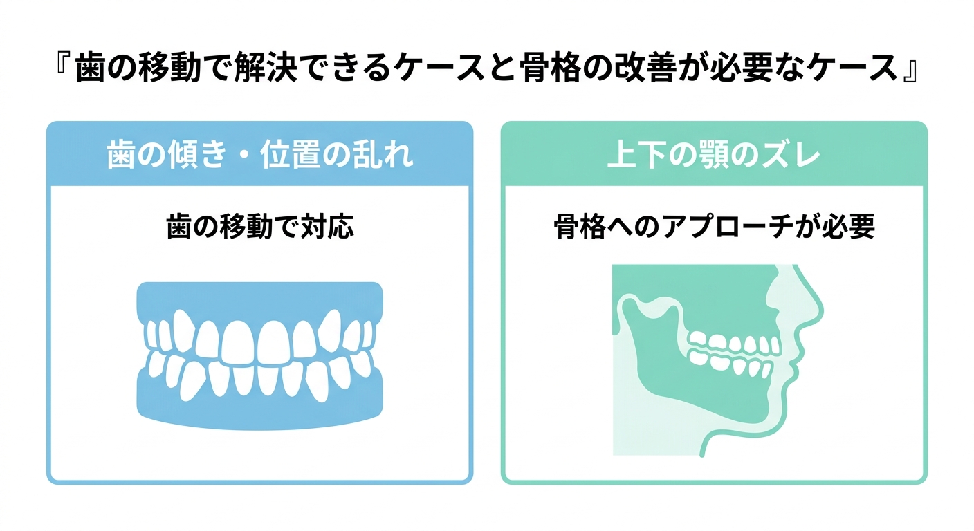 【軸1】歯並びの状態が原因でインビザラインが難しいケース